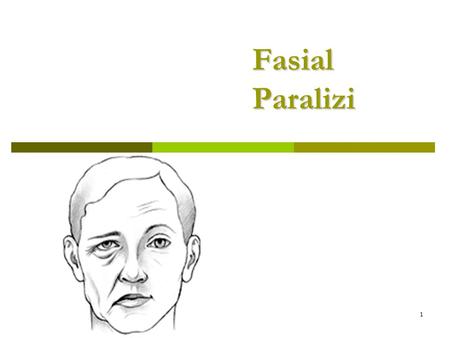 Fasial Paralizi.