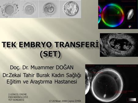Tek Embryo Transferİ (SET)