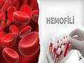 HEMOFİLLİ HASTALIĞI Hemofili hastalığı; Kandaki pıhtılaşmayı sağlayan faktörlerden faktör 8 (VIII) ve 9 (IX)’un hayat boyu eksik ve kanın pıhtılaşmasının.