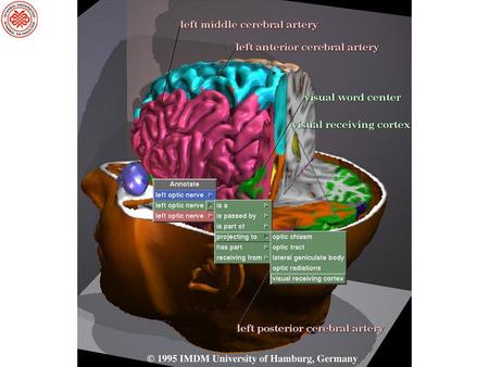 Beynin Yapısal Olarak İncelenmesi sBT (Bilgisayarlı Tomografi): X- ışınlarıyla beynin ince kesitleri alınır sMRG (Manyetik Rezonans Görüntüleme): Beyin.