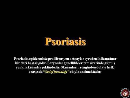 Psoriasis Psoriasis, epidermiste proliferasyon artışıyla seyreden inflamatuar bir deri hastalığıdır. Lezyonlar genellikle eritem üzerinde gümüş renkli.
