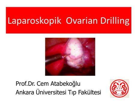 Laparoskopik Ovarian Drilling
