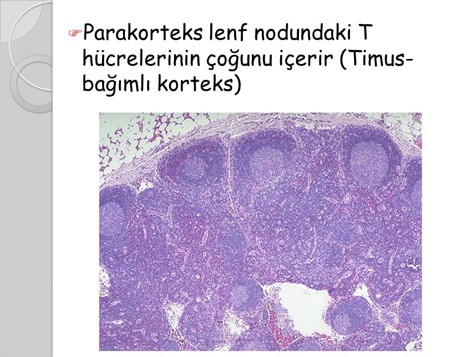 Parakorteks lenf nodundaki T hücrelerinin çoğunu içerir (Timus- bağımlı korteks)