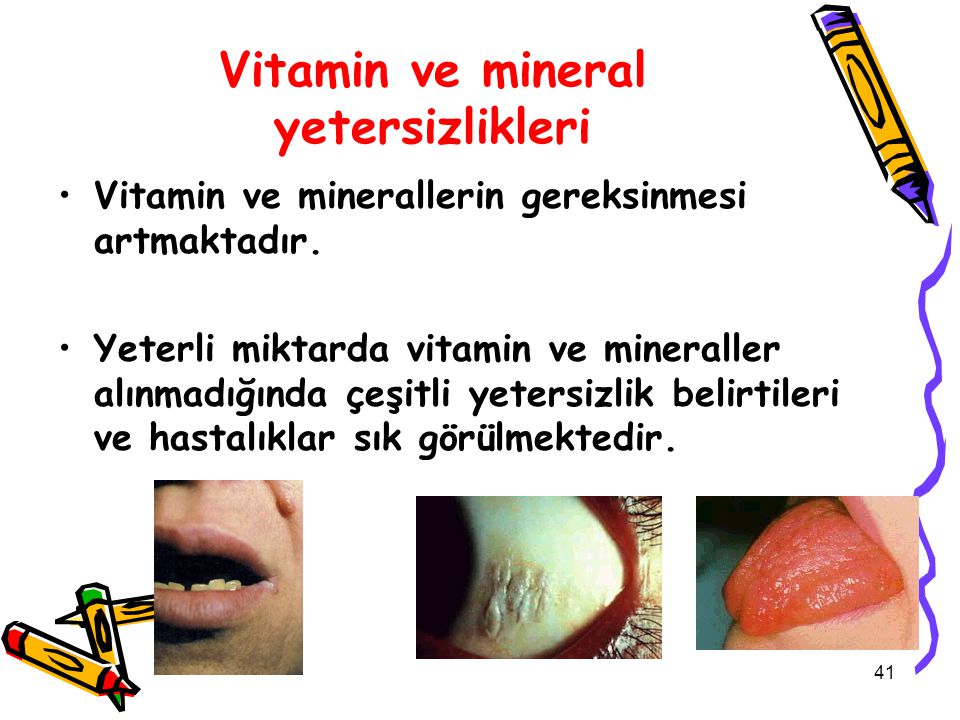 Vitamin ve mineral yetersizlikleri
