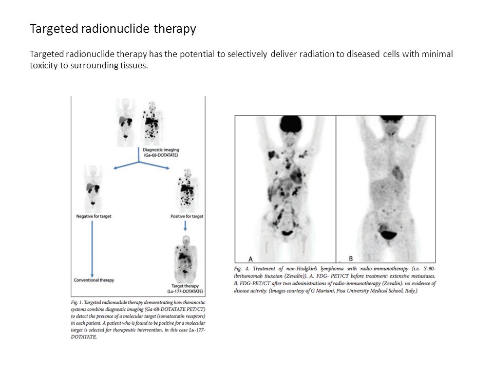 Targeted radionuclide therapy Targeted radionuclide therapy has the potential to selectively deliver radiation to diseased cells with minimal toxicity to surrounding tissues.