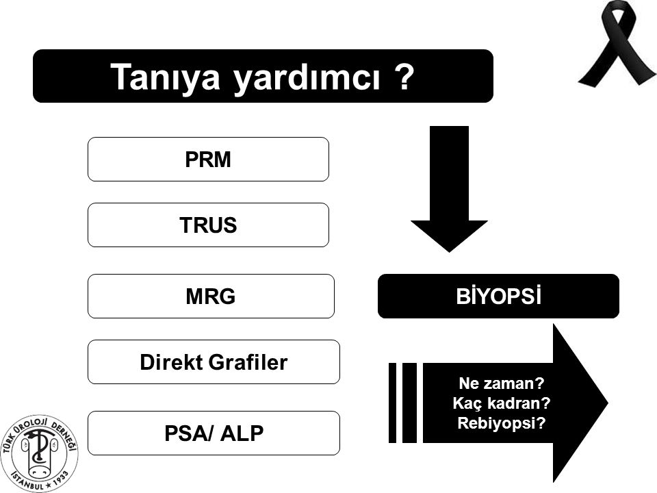 Tanıya yardımcı PRM TRUS MRG BİYOPSİ Direkt Grafiler PSA/ ALP