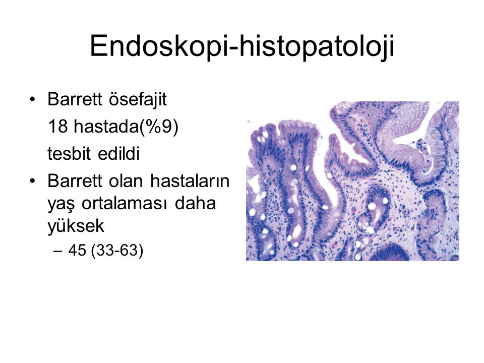 Endoskopi-histopatoloji