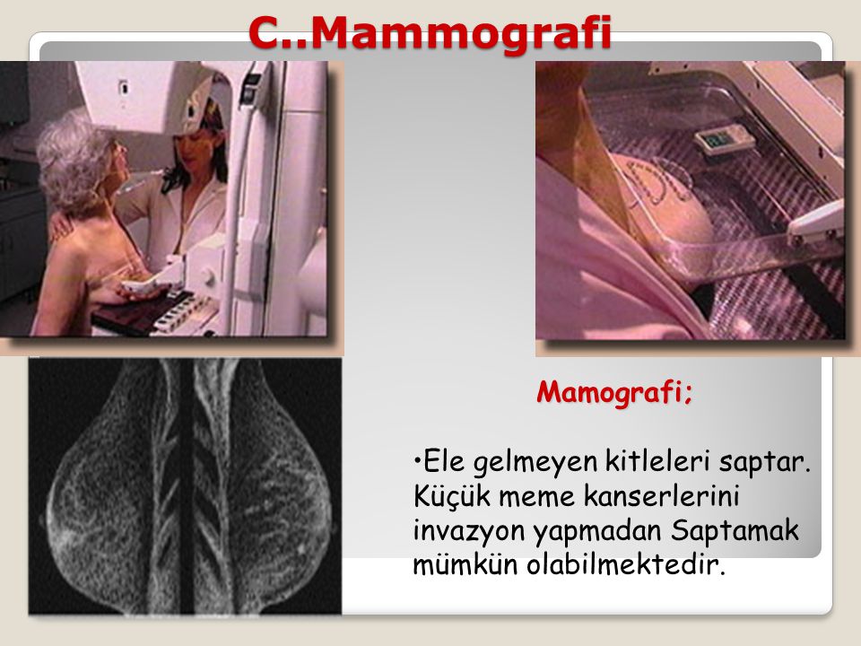C..Mammografi Mamografi;