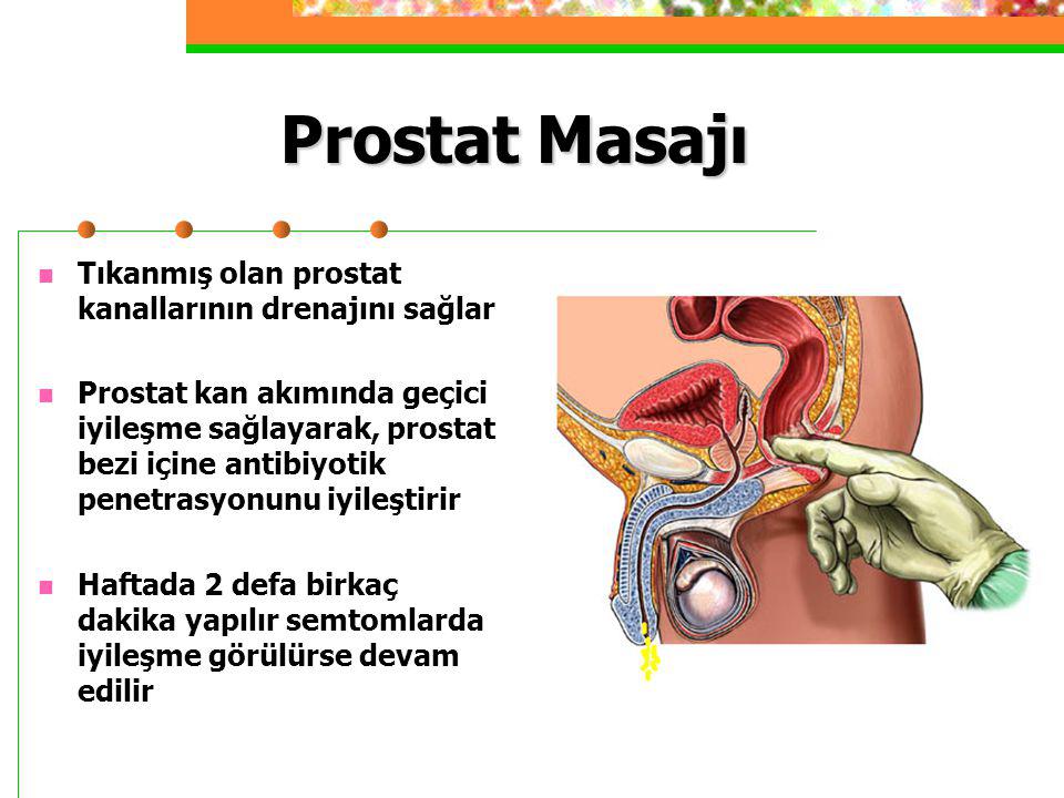 Prostat Masajı Tıkanmış olan prostat kanallarının drenajını sağlar