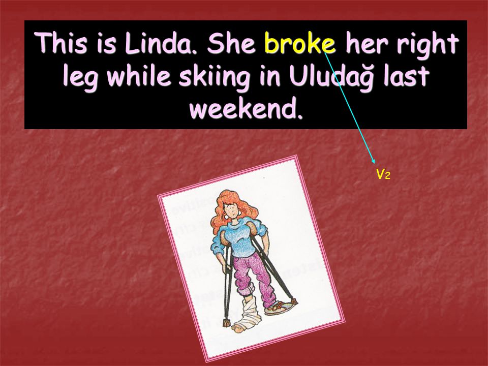 This is Linda. She broke her right leg while skiing in Uludağ last weekend.