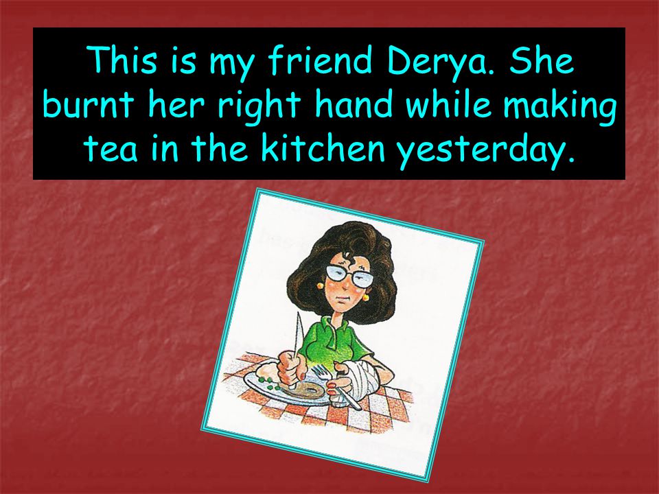 This is my friend Derya. She burnt her right hand while making tea in the kitchen yesterday.