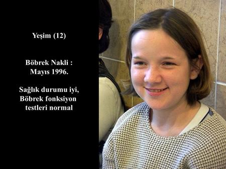 Yeşim (12) Böbrek Nakli : Mayıs 1996. Sağlık durumu iyi,