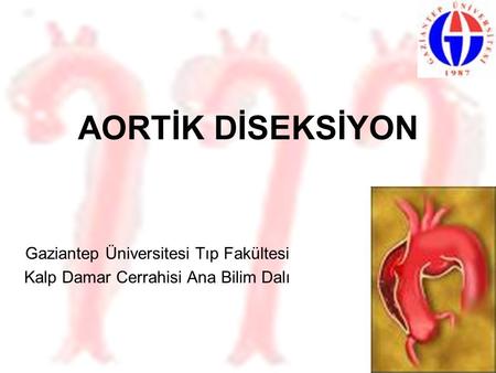 AORTİK DİSEKSİYON Gaziantep Üniversitesi Tıp Fakültesi