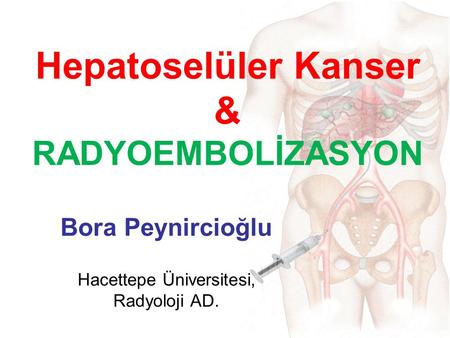 Hepatoselüler Kanser & RADYOEMBOLİZASYON