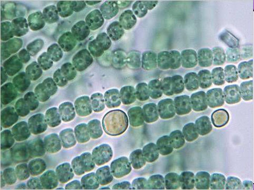 Простейшие водоросли грибы. Цианобактерии Анабена. Носток цианобактерия. Носток водоросль. Азолла цианобактерии.