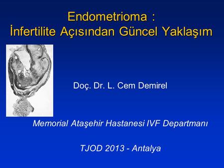 Endometrioma : İnfertilite Açısından Güncel Yaklaşım