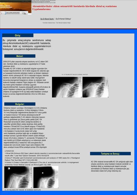 LİTERATÜR: 1-Stroet MA,Schreurs BW,Open Lateral clavicle resection in acromioclaviculer osteoarthritis:favourable results after 1 year Ned Tijdschr Geneeskd.