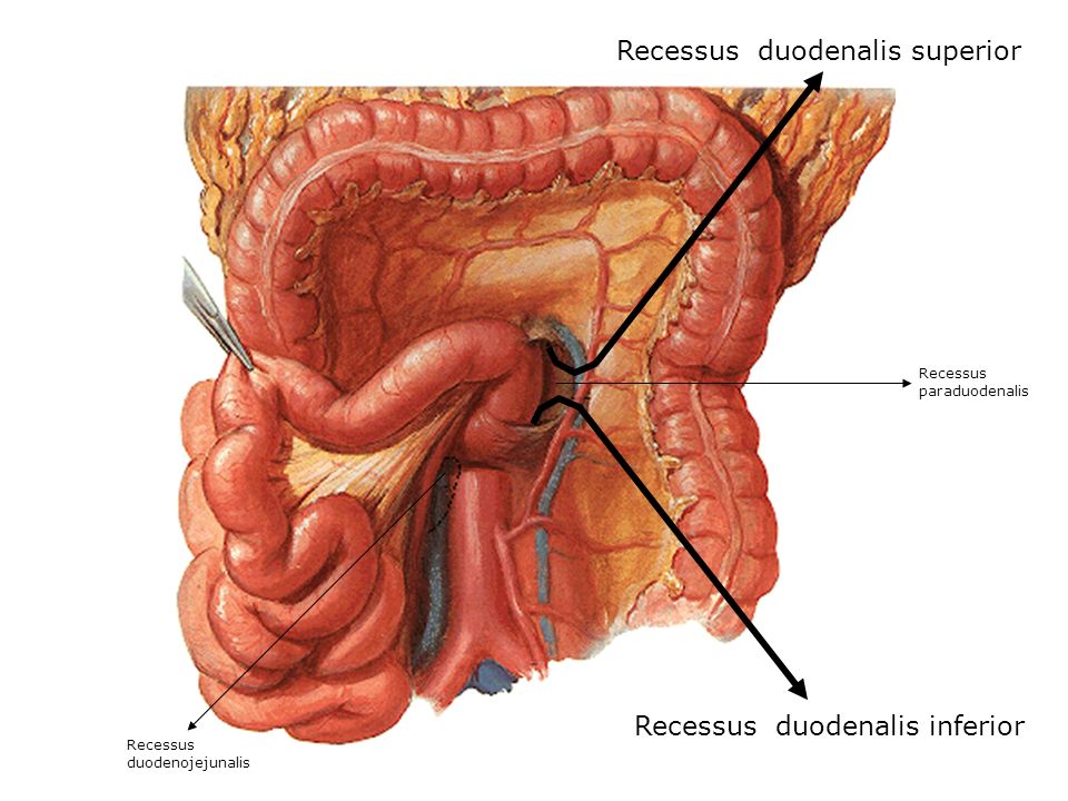 Recessus duodenalis