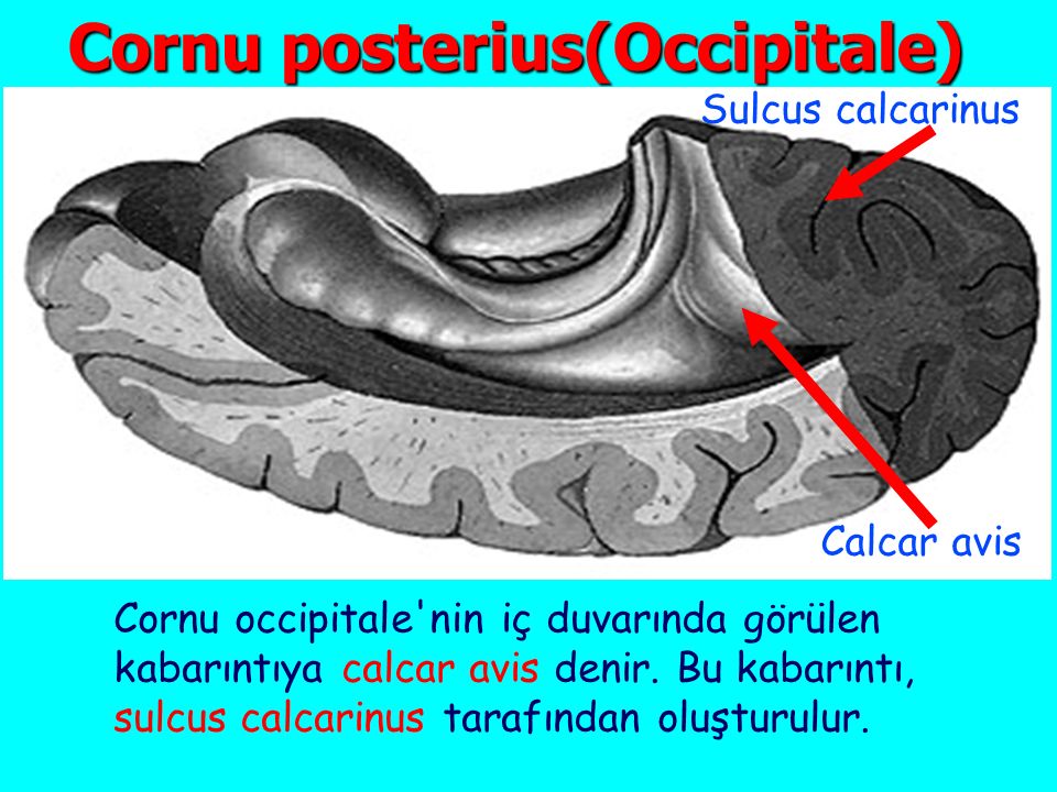 Cornu posterius(Occipitale)