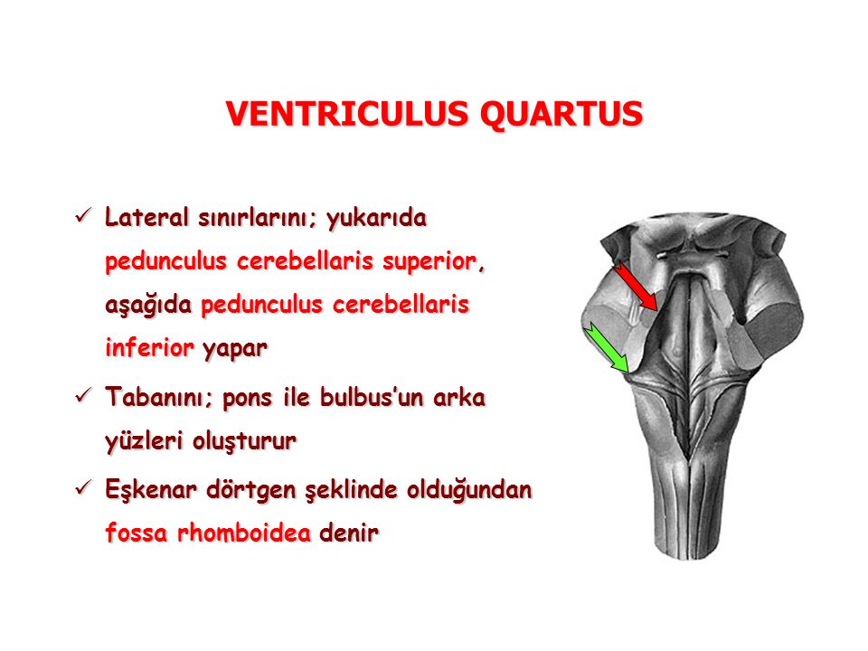 VENTRICULUS QUARTUS Lateral sınırlarını; yukarıda pedunculus cerebellaris superior, aşağıda pedunculus cerebellaris inferior yapar.