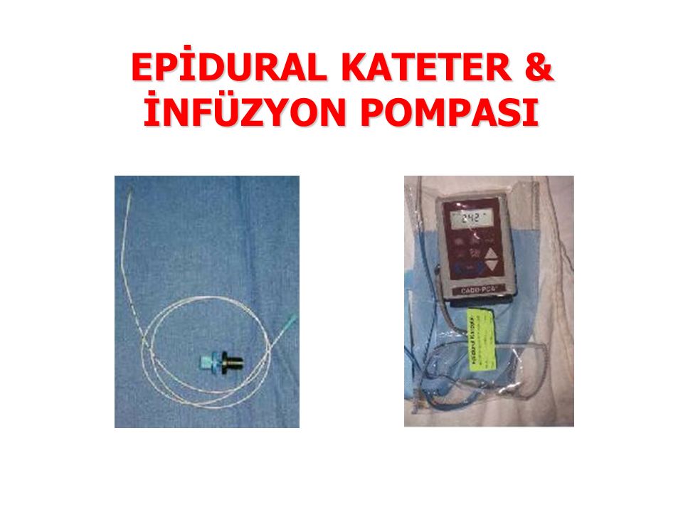 EPİDURAL KATETER & İNFÜZYON POMPASI