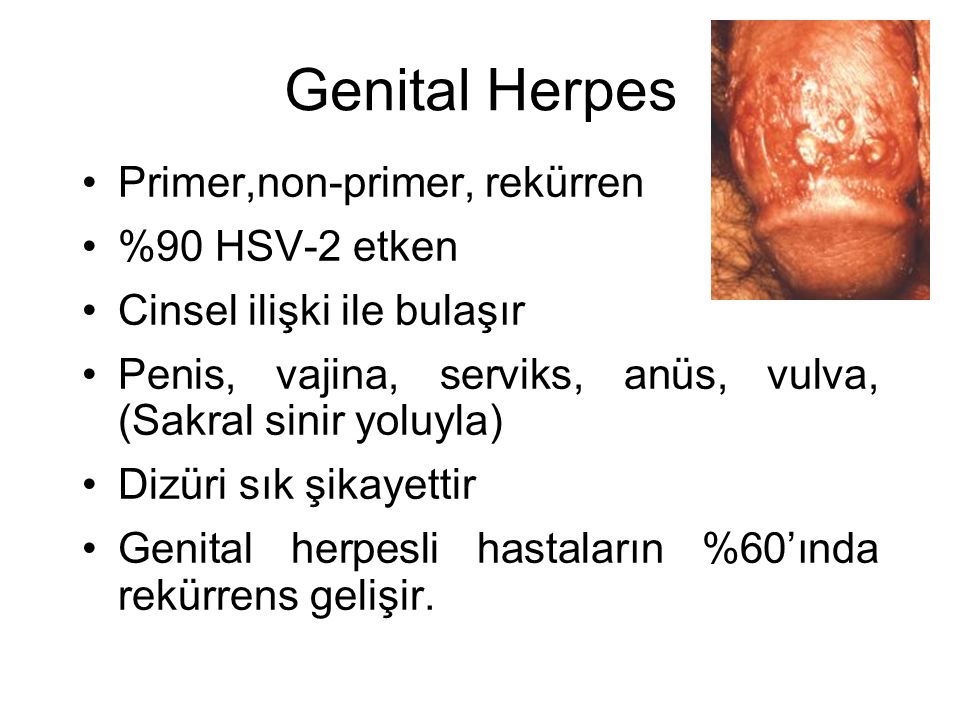 Herpes Pornstars