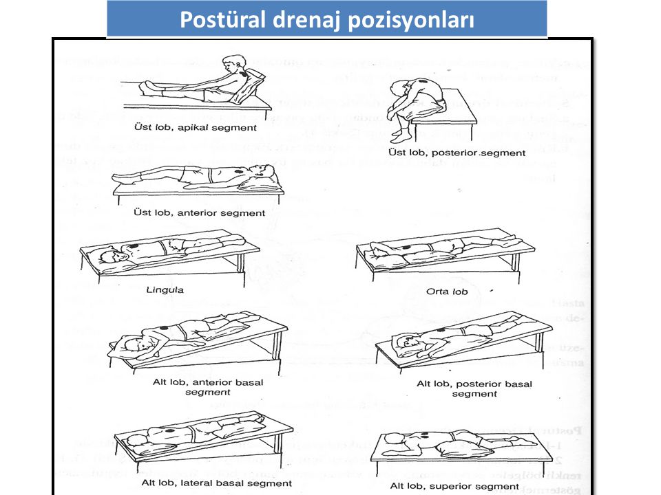Постуральный дренаж. Постуральный дренаж для детей до 3 лет необходимо. Postural Drainage Table.