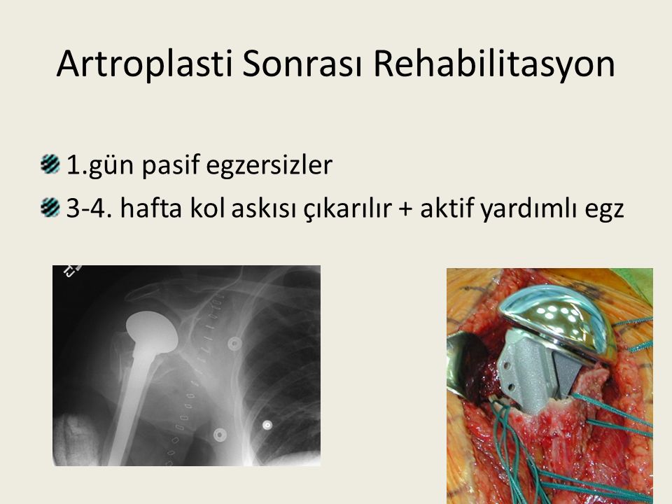 Artroplasti Sonrası Rehabilitasyon