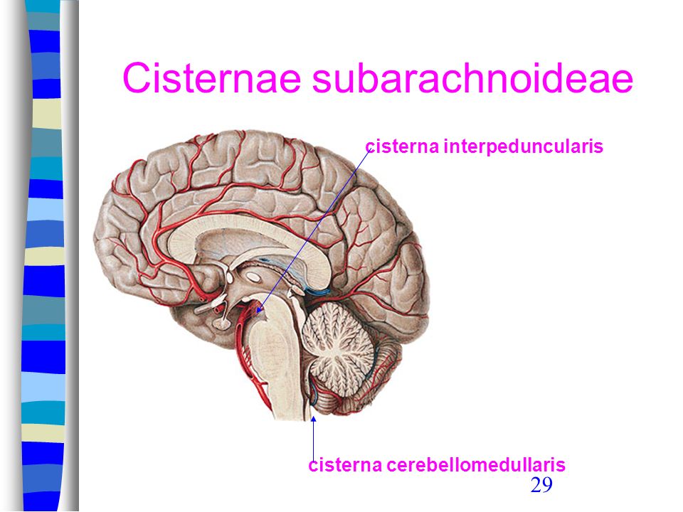 Cisternae subarachnoideae