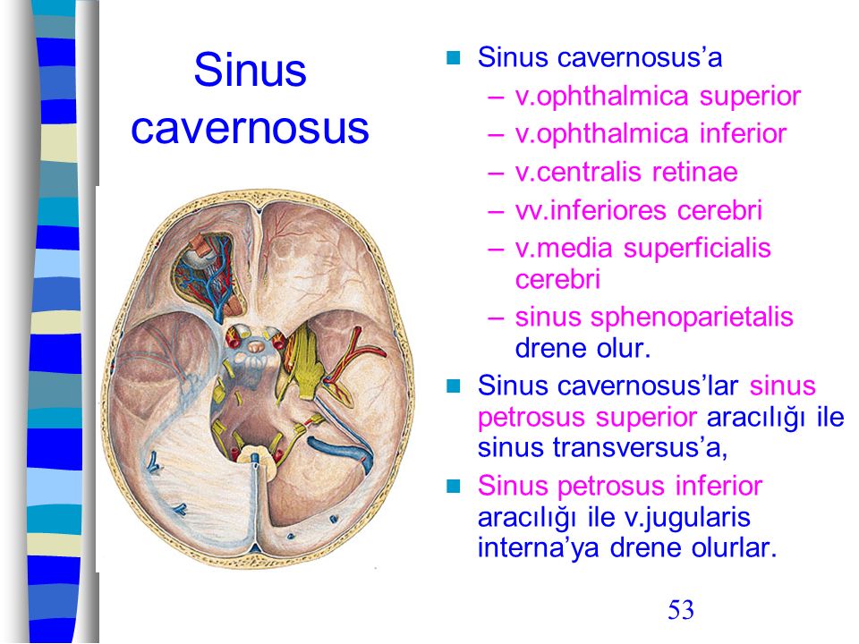 Sinus cavernosus Sinus cavernosus’a v.ophthalmica superior
