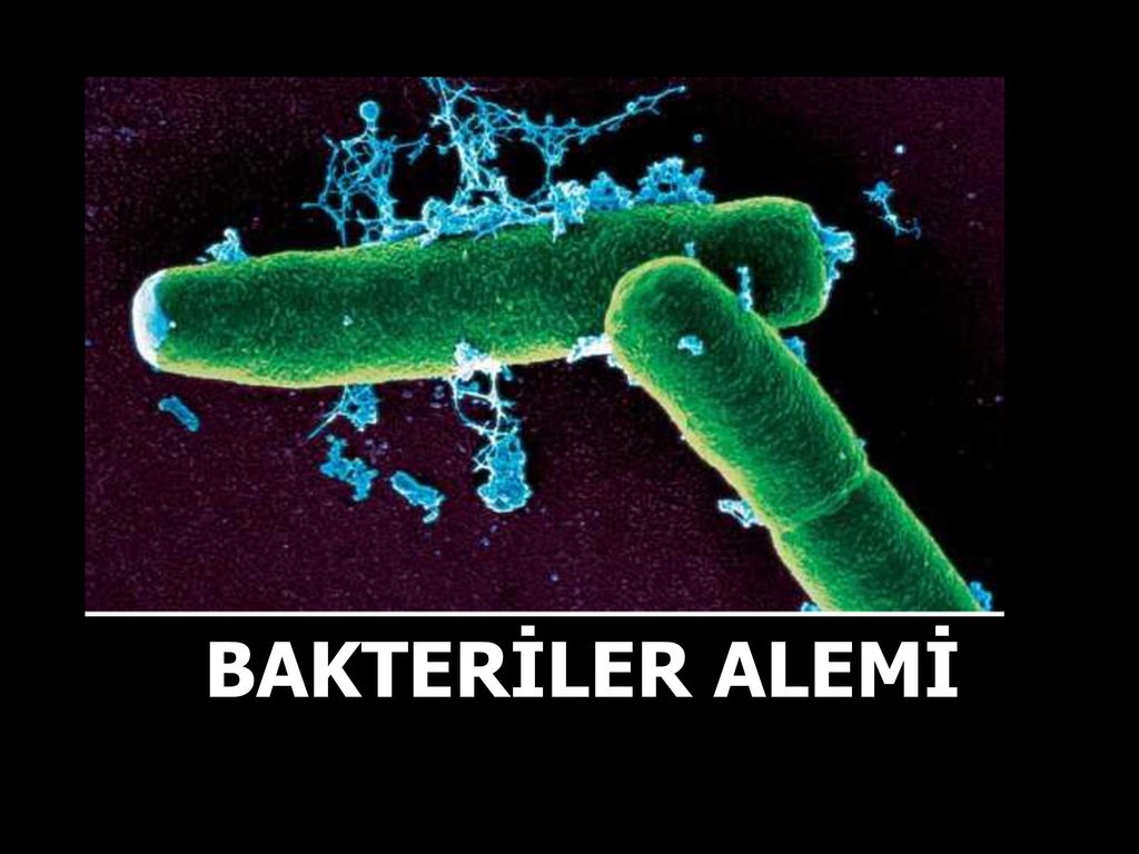 Бактерия вызывающая язву. Сибирская язва возбудитель бактерия. Bacillus anthracis Сибирская язва. Бациллус антрацис возбудитель.