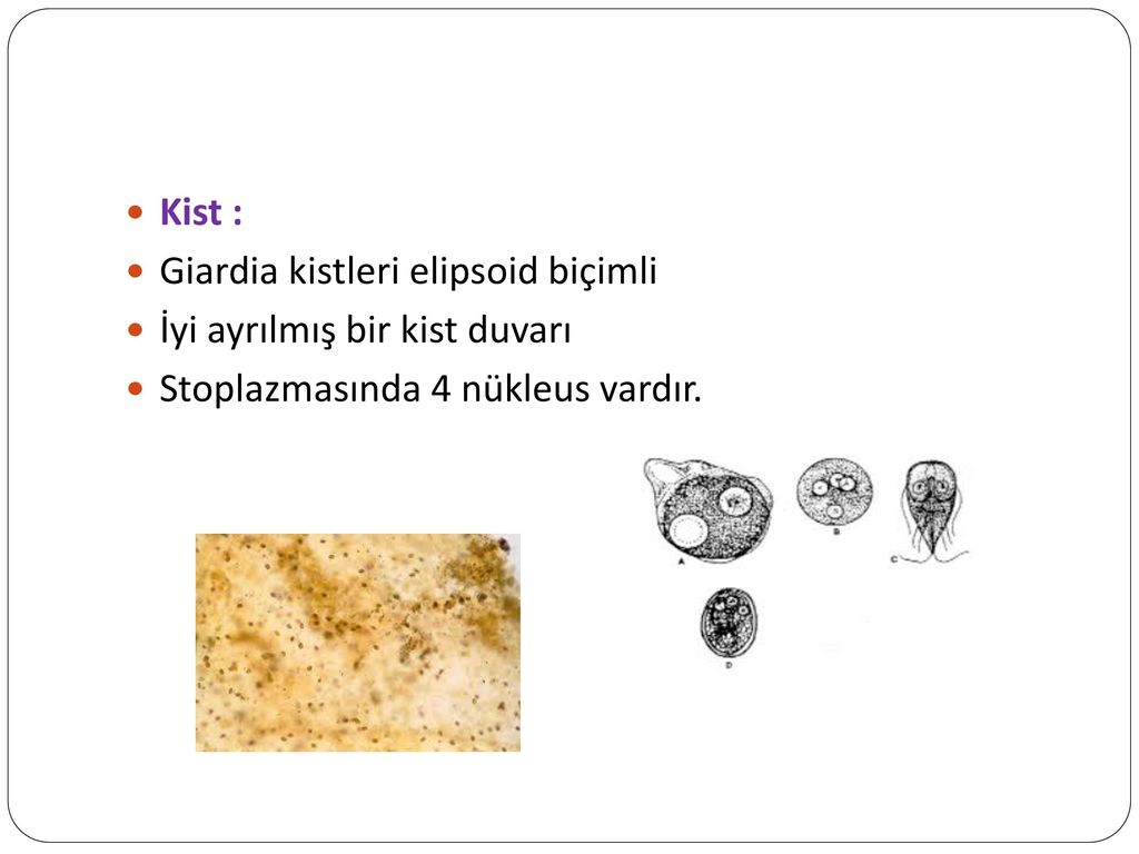 Kist : Giardia kistleri elipsoid biçimli. İyi ayrılmış bir kist duvarı.
