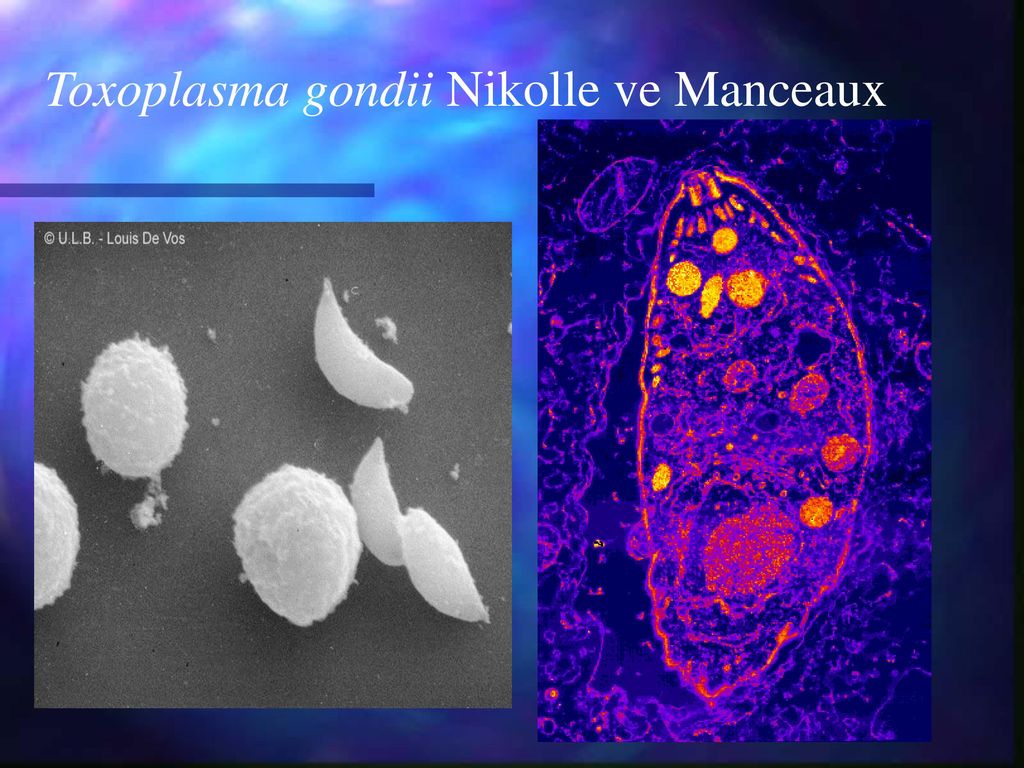 Toxoplasma gondii