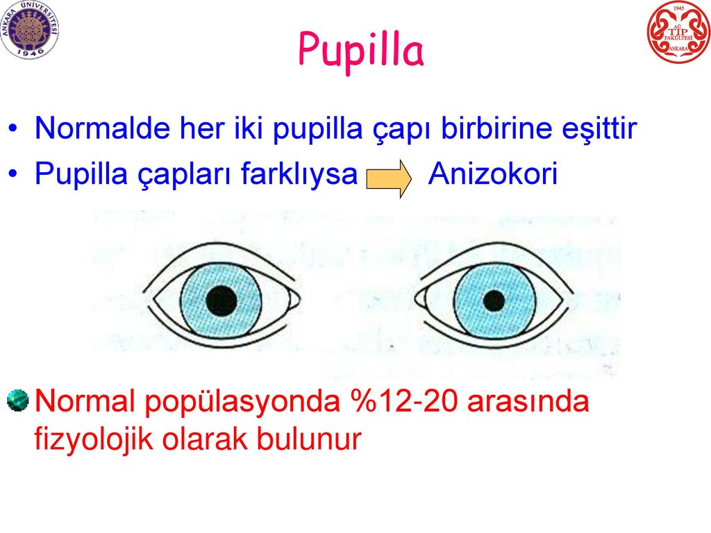 Pupilla Normalde her iki pupilla çapı birbirine eşittir