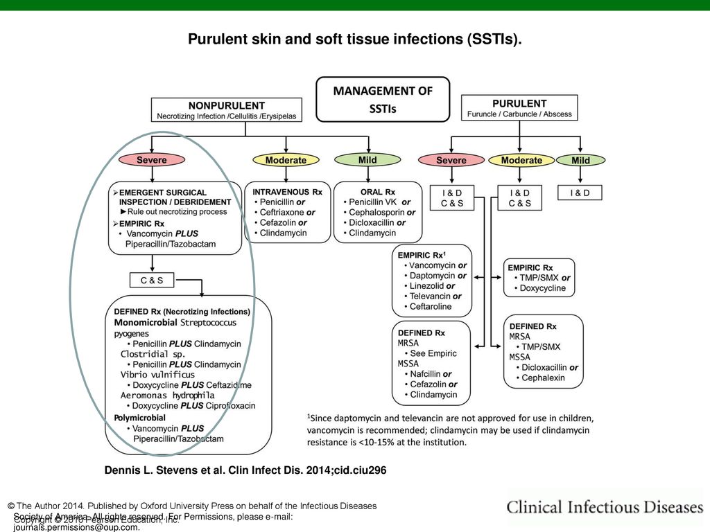 Bacterial And Viral Skin And Soft Tissue Infections Ppt Indir