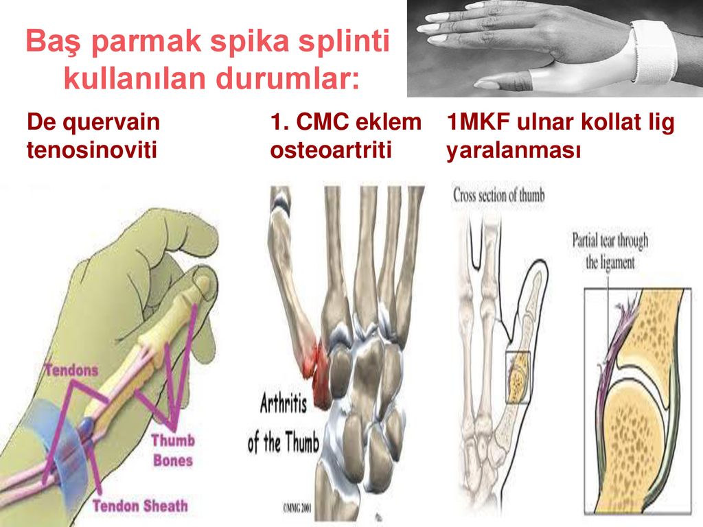 Sulu Qmcik Parmak Atma