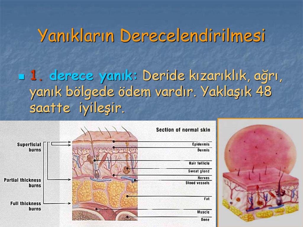 Yanik Sicak Arpmasi Ve Donmada Ppt Indir