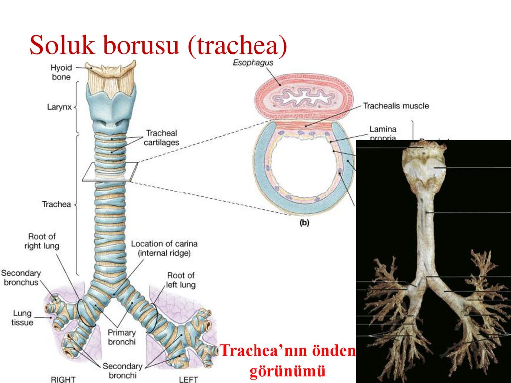 Легкие трахеи ткани