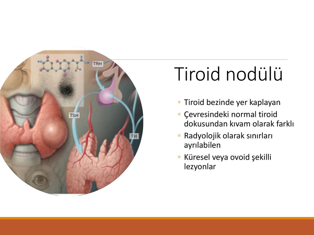 Tiroid Hastalıklarına Yaklaşım - Ppt Indir