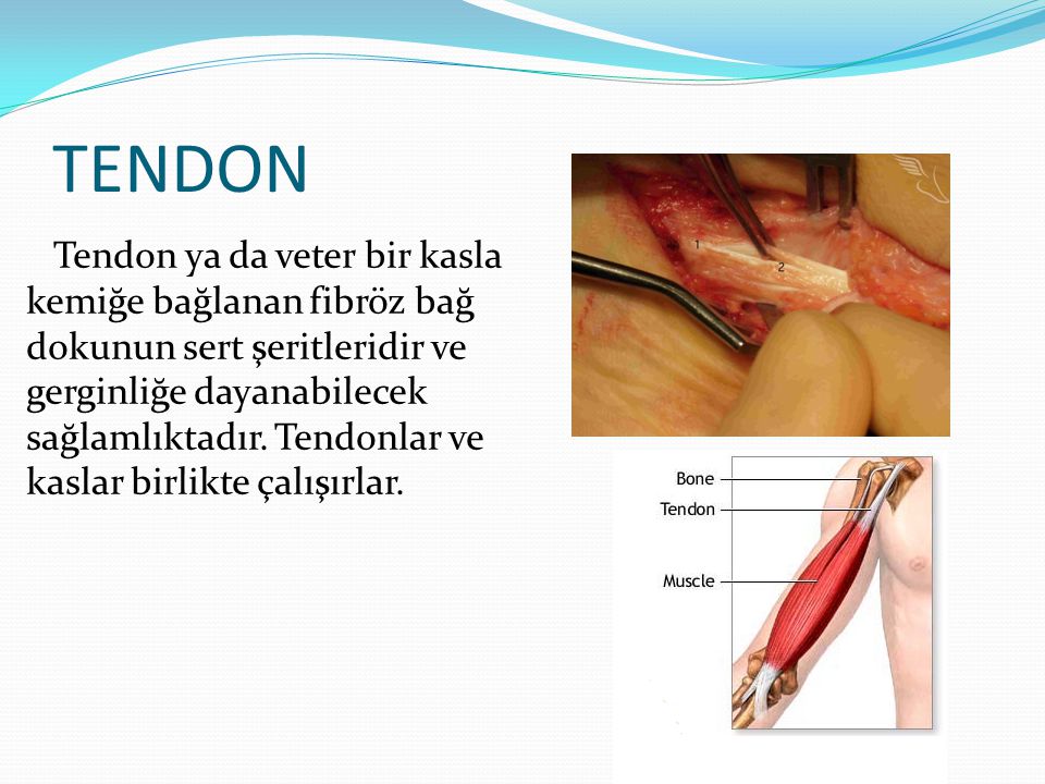 Que es bueno para el tendon inflamado