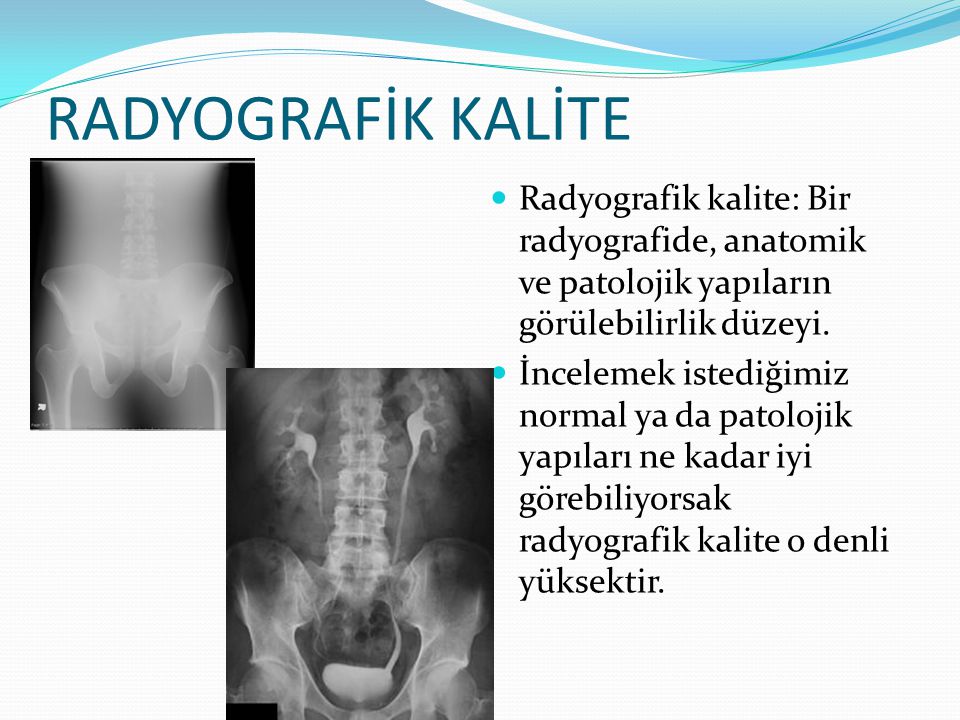 RADYOGRAFİK KALİTE Radyografik kalite: Bir radyografide, anatomik ve patolojik yapıların görülebilirlik düzeyi.