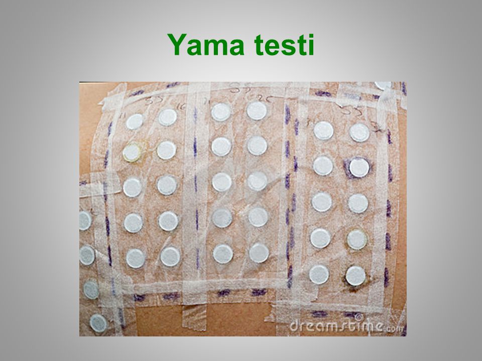 Yama testi