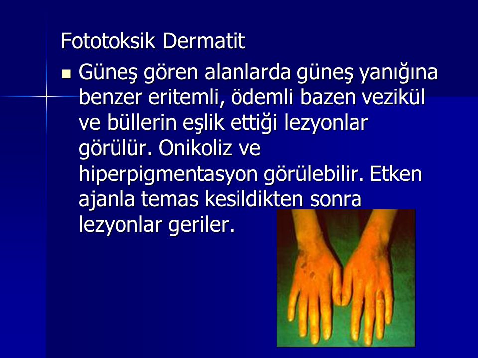 Fototoksik Dermatit
