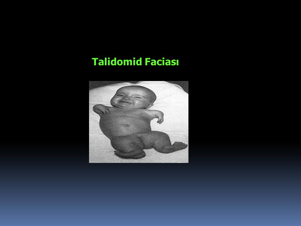 Talidomid Faciası