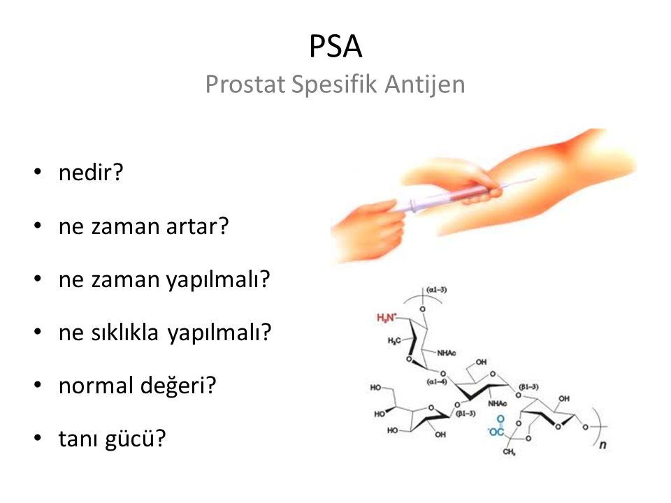 PSA Prostat Spesifik Antijen