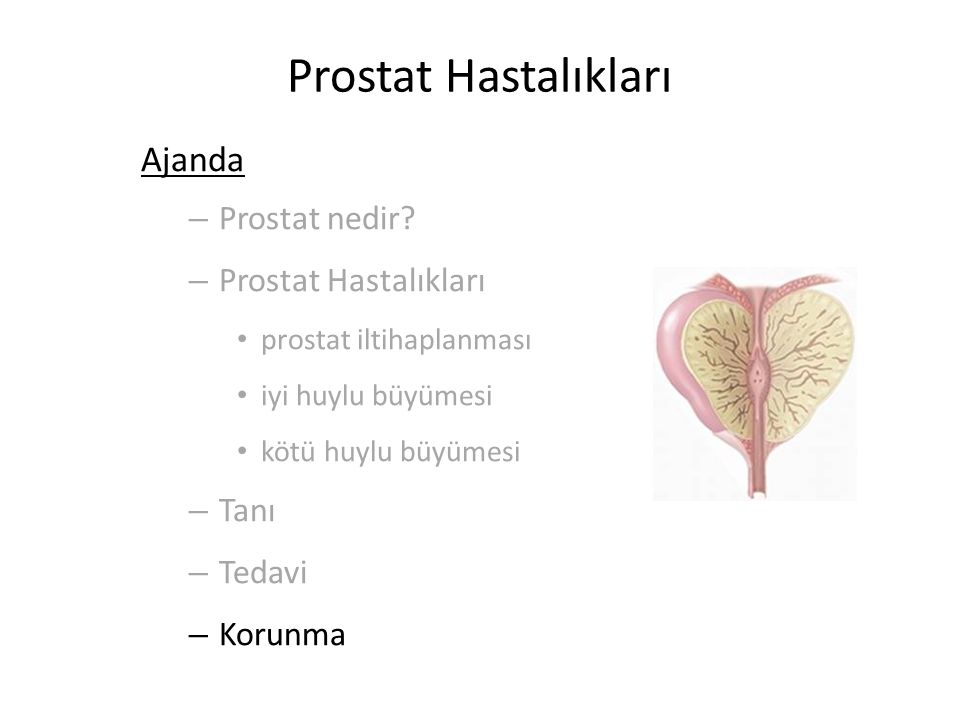 Prostat Hastalıkları Ajanda Prostat nedir Prostat Hastalıkları Tanı