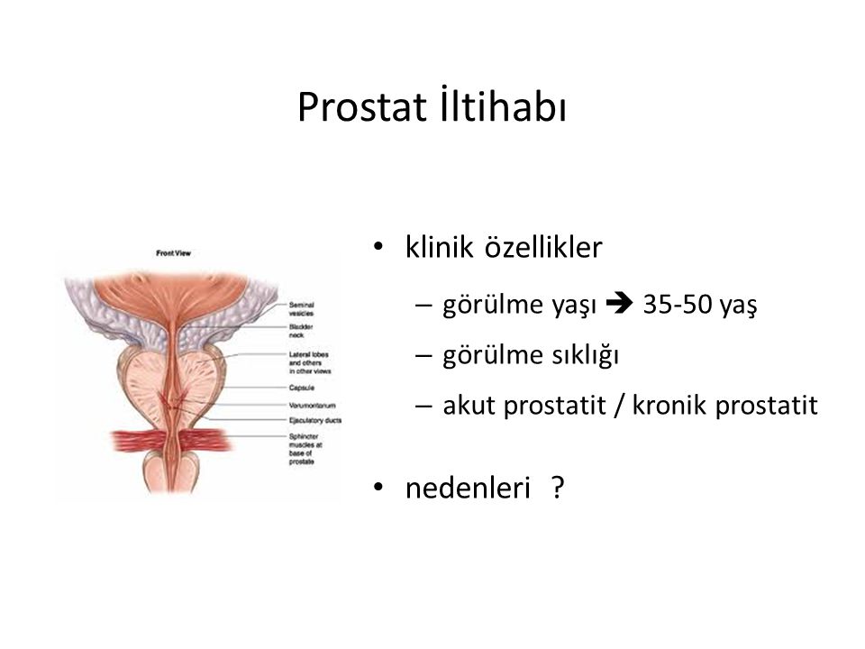 Prostat İltihabı klinik özellikler nedenleri