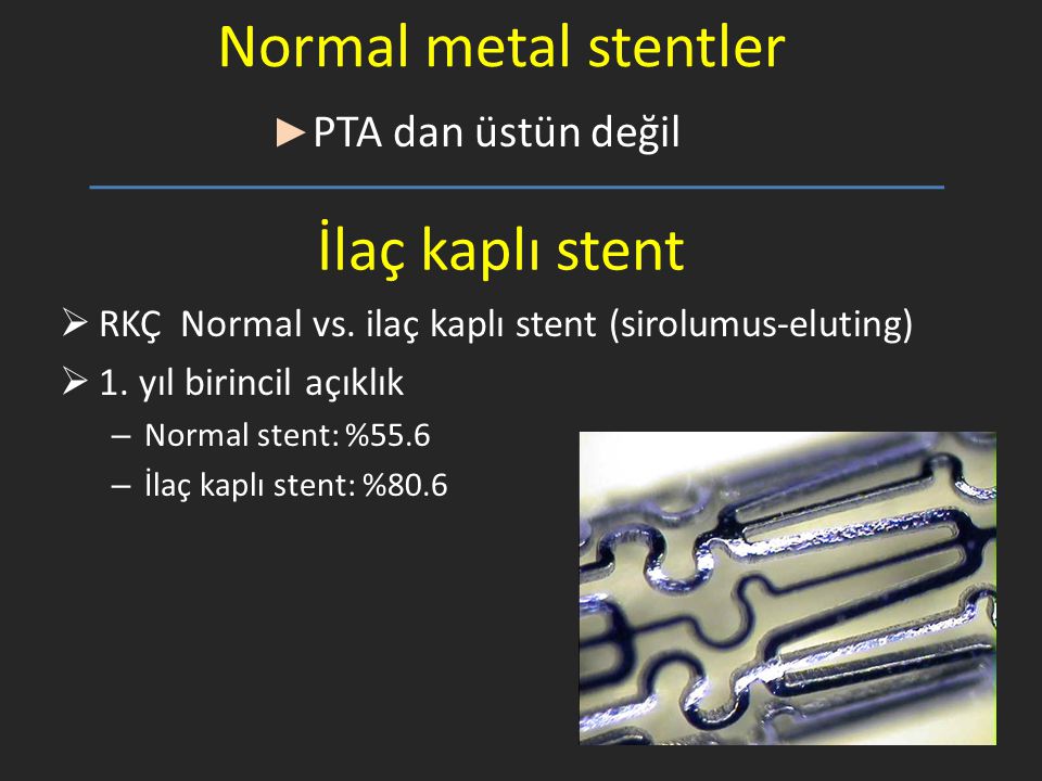 Normal metal stentler İlaç kaplı stent PTA dan üstün değil