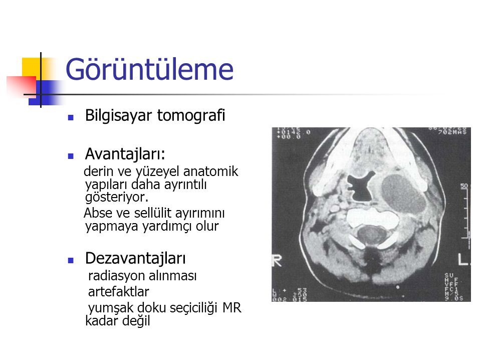 Görüntüleme Bilgisayar tomografi Avantajları: Dezavantajları