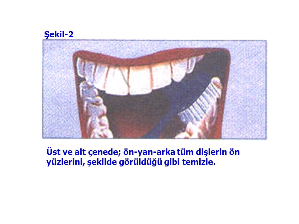 Şekil-2 Üst ve alt çenede; ön-yan-arka tüm dişlerin ön yüzlerini, şekilde görüldüğü gibi temizle.